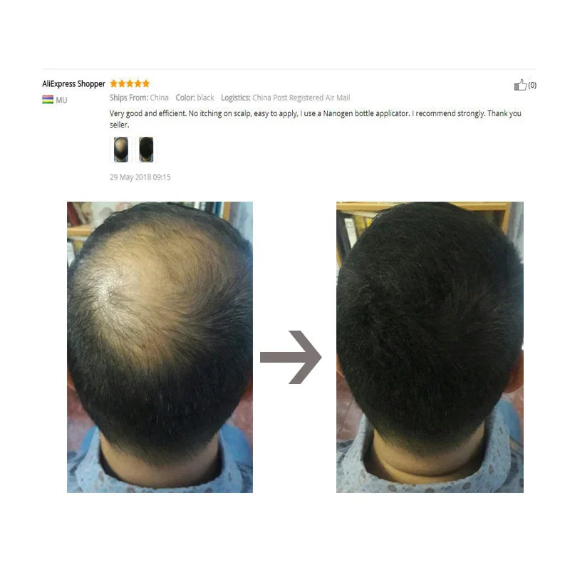 Keratin Hair Fibers
